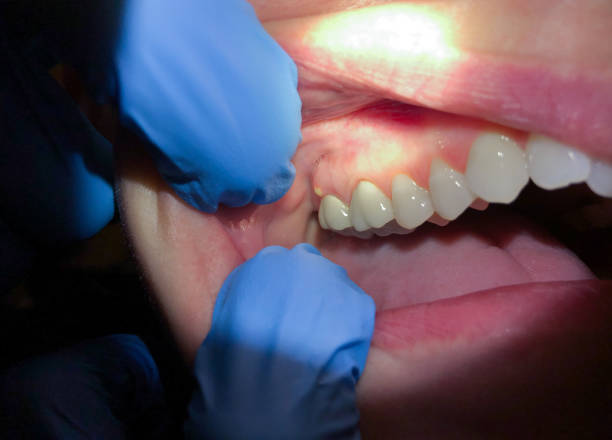 Best Emergency Treatment for Jaw Pain or Injury in Edgewood, TX