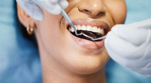 Best Emergency Treatment for Oral Infections in Edgewood, TX