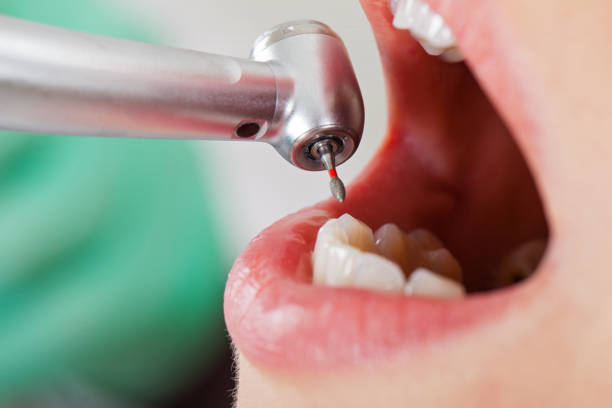 Best Walk-In Emergency Dental Services in Edgewood, TX